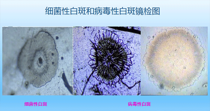 虾疫病j9游会真人游戏第一品牌机构